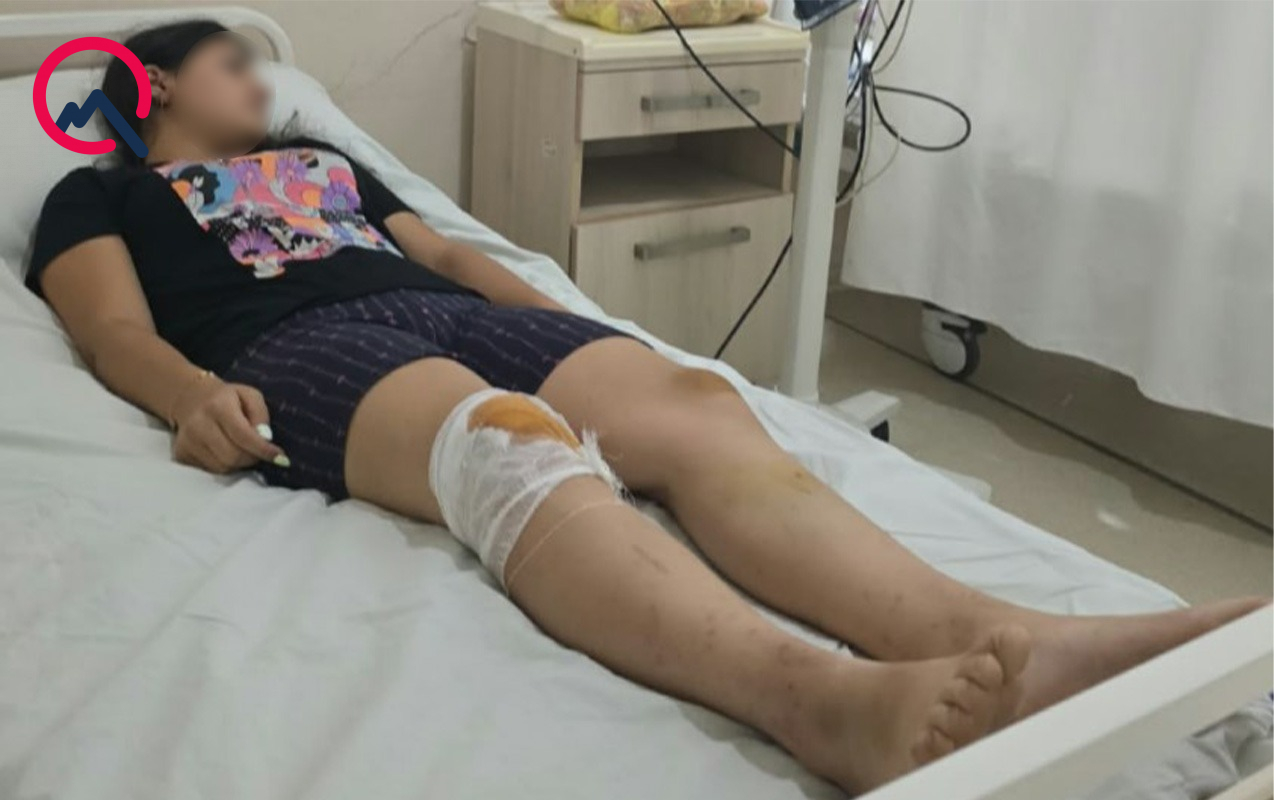 Ağdaşda attraksion aşdı, bacı-qardaş yaralandı - VİDEO 2 4ae01c7d a505 44ce 9948 60c19d8e528e 1
