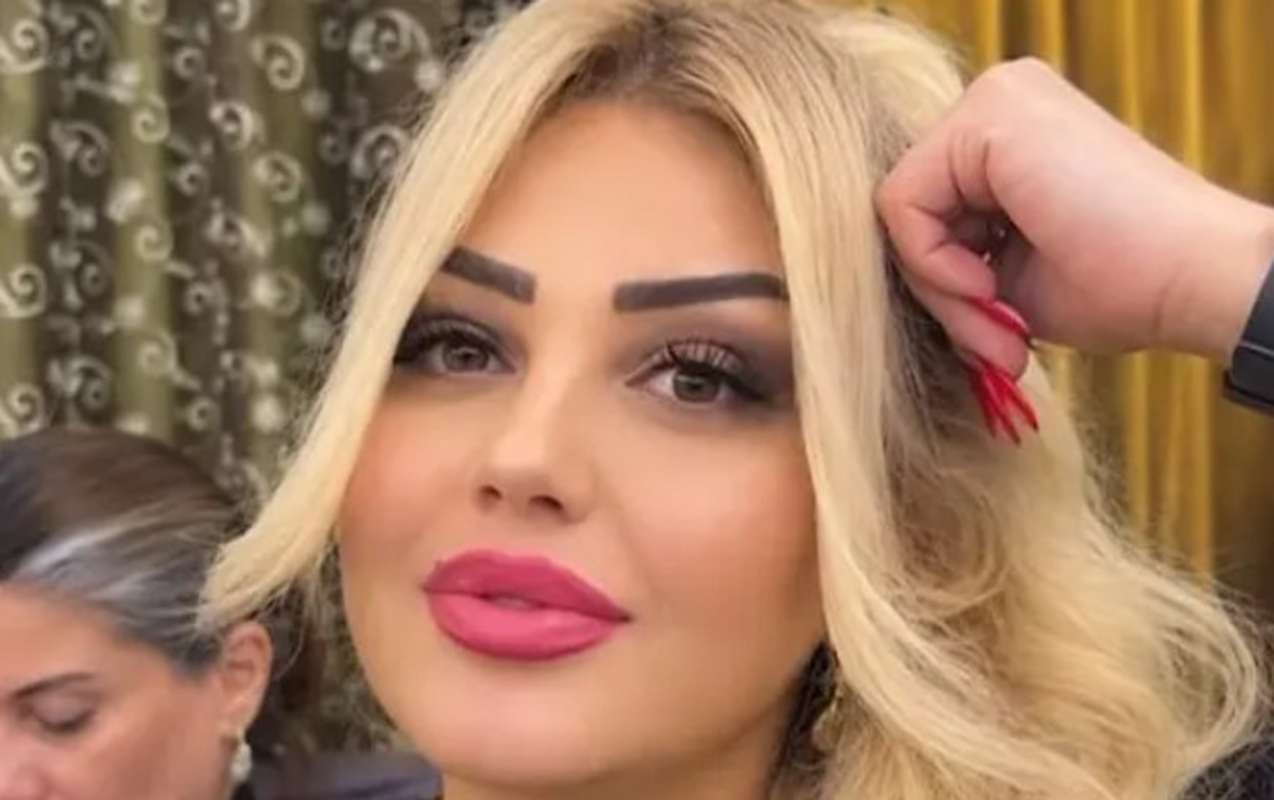 bakida-qadin-disini-cekdirdiyine-gore-vefat-edib